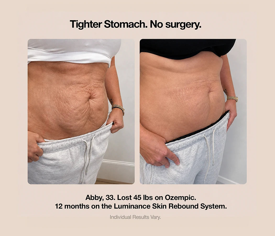 non-invasive devices for skin laxity abdomen rapid weight loss glp-1 GLP-1 Skin Rebound System