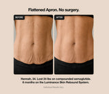 glp-1 loose skin glp 1 saggy  Love Your Results, Restore Your Glow  Losing weight with medications is a major milestone, but rapid transformation can sometimes leave your feeling a little "deflated" Treatments for loose skin after