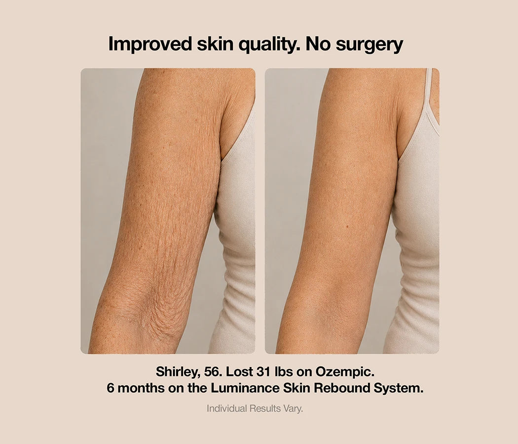 GLP-1 Skin Rebound System – Luminance RED